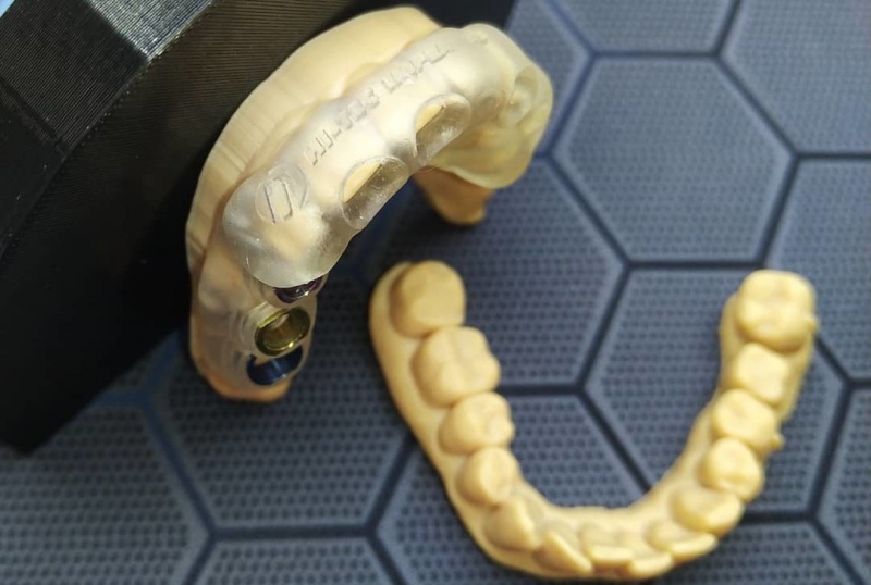 3D-печать меняет стоматологию