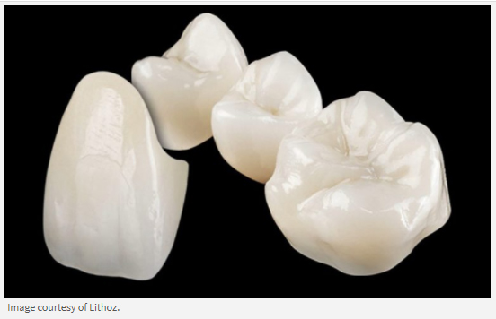 3D Printed Ceramic Medical Implants