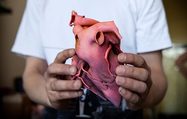  применение 3D-печати в медицине 