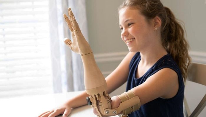 3D Printed Prostheses
