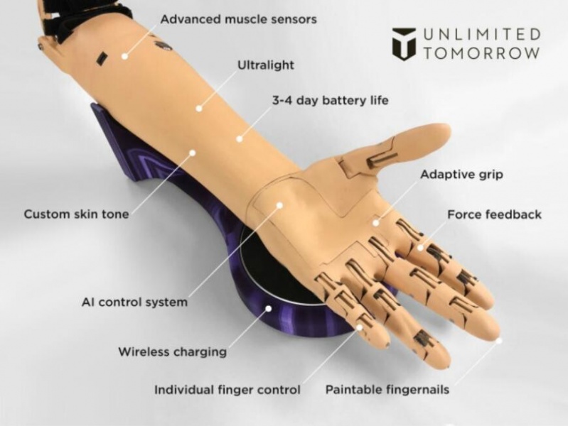 3D-печатные бионические протезы от Unlimited Tomorrow