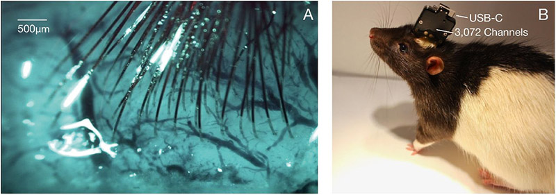  А — пример изображения, показывающего поверхность коры с имплантированными нитями и минимальным кровотечением; B –упакованное сенсорное устройство, имплантированное крысе