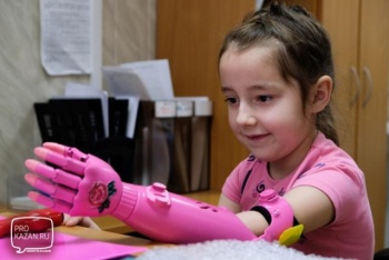 В Казани детям начали ставить протезы руки, распечатанные на 3D-принтере