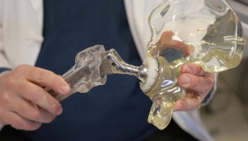 Российские ученые намерены выращивать суставы с помощью 3D-принтера