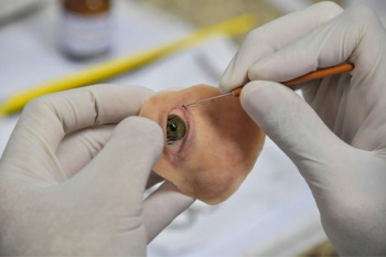 Жительница Бразилии Дениз Висентин, потерявшая правый глаз и часть челюсти из-за раковой опухоли, получила протез лица, разработ