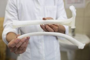 В Болгарии впервые осуществили пересадку напечатанного на 3D-принтере ребра