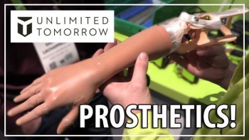 Unlimited Tomorrow представила новую технологию изготовления протезов