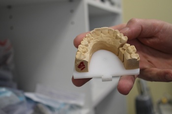 Компания «Семейная стоматология» первой в Тверской области начала использовать уникальный 3D-принтер по металлу
