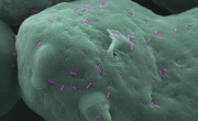 3D-печатные детали были эффективны против бактерий Pseudomonas aeruginosa (фиолетового цвета)