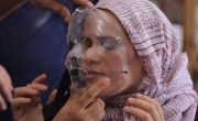 Напечатанные компрессионные маски для лечения ожогов