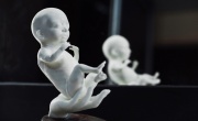 Стартап из Уфы превращает снимки УЗИ в 3D-модели эмбрионов