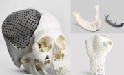 3D-печать помогла создать конструкции для регенерации костей