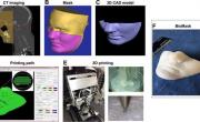 BioMask – напечатанная на 3D-принтере маска для лечения травм и ожогов лица 