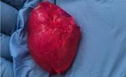 3D-напечатаное человеческое мини-сердце
