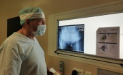 В Смоленске провели уникальную операцию по эндопротезированию с использованием 3D-импланта