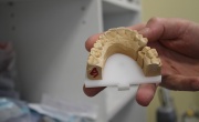Компания «Семейная стоматология» первой в Тверской области начала использовать уникальный 3D-принтер по металлу